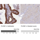 Anti-PLXNB1 Antibody