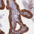 Anti-PLXNB1 Antibody