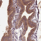 Immunohistochemical staining of human fallopian tube shows moderate cytoplasmic/ membranous positivity in glandular cells.