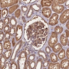 Immunohistochemical staining of human kidney shows moderate cytoplasmic positivity in cells in tubules and moderate membranous/ cytoplasmic positivity in cells in glomeruli.