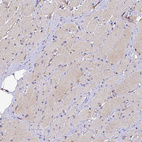 Immunohistochemical staining of human skeletal muscle shows very weak cytoplasmic positivity in myocytes.