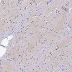 Immunohistochemical staining of human skeletal muscle shows very weak cytoplasmic positivity in myocytes.
