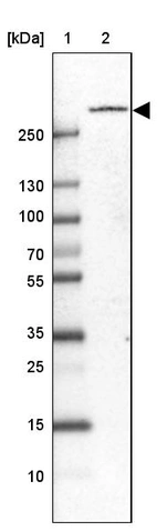 Lane 1: Marker [kDa] 250, 130, 100, 70, 55, 35, 25, 15, 10_br/_Lane 2: Human cell line RT-4
