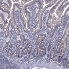 Immunohistochemical staining of human small intestine shows strong cytoplasmic positivity in enteroendocrine cells.