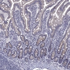 Immunohistochemical staining of human small intestine shows strong cytoplasmic positivity in enteroendocrine cells.