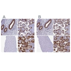 Immunohistochemical staining of human endometrium, placenta, skeletal muscle and small intestine using Anti-MYO5B antibody HPA040593 (A) shows similar protein distribution across tissues to independent antibody HPA040902 (B).