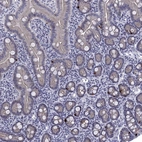 Immunohistochemical staining of human duodenum shows strong cytoplasmic positivity in enteroendocrine cells.