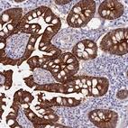Immunohistochemical staining of human small intestine shows membranous and cytoplasmic positivity in glandular cells.