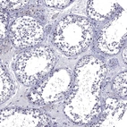 Immunohistochemical staining of human testis shows no positivity in cells in seminiferous ducts as expected.