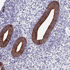 Anti-MYO5B Antibody