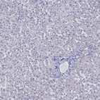 Immunohistochemical staining of human liver shows no positivity in hepatocytes as expected.
