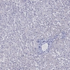 Immunohistochemical staining of human liver shows no positivity in hepatocytes as expected.