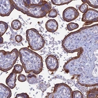 Immunohistochemical staining of human placenta shows moderate to strong cytoplasmic and membranous positivity in trophoblastic cells.