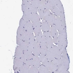 Immunohistochemical staining of human skeletal muscle shows no positivity in myocytes as expected.