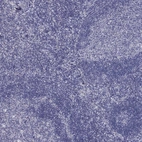 Immunohistochemical staining of human tonsil shows no positivity in germinal and non-germinal center cells as expected.