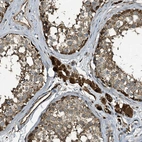 Anti-TPGS2 Antibody