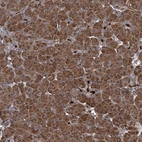 Anti-CCDC102A Antibody