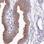 Immunohistochemical staining of human fallopian tube shows moderate cytoplasmic positivity in glandular cells.