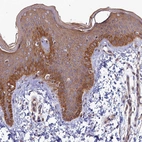 Immunohistochemical staining of human skin shows moderate cytoplasmic positivity in squamous epithelial cells.