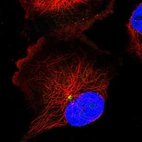 Immunofluorescent staining of human cell line U-251 MG shows localization to centrosome.