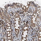 Immunohistochemical staining of human rectum shows strong granular cytoplasmic positivity in lymphoid cells.