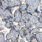 Immunohistochemical staining of human placenta shows moderate granular cytoplasmic positivity in trophoblastic cells.