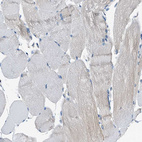 Immunohistochemical staining of human skeletal muscle shows no positivity in myocytes as expected.