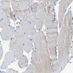 Immunohistochemical staining of human skeletal muscle shows no positivity in myocytes as expected.