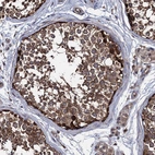 Immunohistochemical staining of human testis shows strong cytoplasmic positivity in cells in seminiferous ducts.