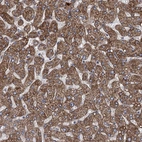 Immunohistochemical staining of human liver shows strong cytoplasmic positivity in hepatocytes.