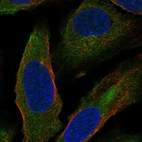 Immunofluorescent staining of human cell line U-2 OS shows localization to cytosol & centrosome.