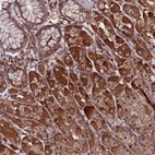 Anti-MEX3C Antibody