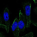 Immunofluorescent staining of human cell line U-251 MG shows localization to vesicles.