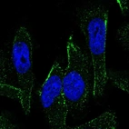 Immunofluorescent staining of human cell line U-251 MG shows localization to vesicles.
