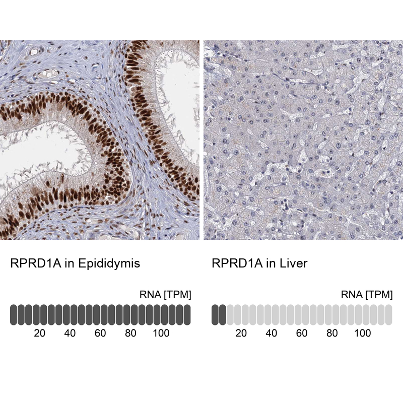 Anti-RPRD1A Antibody