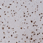 Immunohistochemical staining of human cerebral cortex shows strong nuclear positivity in neuronal cells and glial cells.