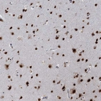 Immunohistochemical staining of human cerebral cortex shows strong nuclear positivity in neuronal cells and glial cells.