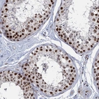 Immunohistochemical staining of human testis shows strong nuclear positivity in cells in seminiferous ducts.