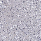 Immunohistochemical staining of human liver shows no nuclear positivity in hepatocytes as expected.