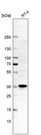 Western blot analysis in human cell line RT-4.