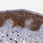 Anti-SCUBE3 Antibody