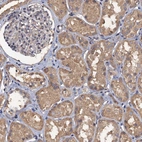Immunohistochemical staining of human kidney shows moderate cytoplasmic positivity in cells in tubules.