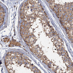 Anti-SCUBE3 Antibody