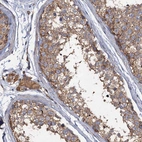 Immunohistochemical staining of human testis shows moderate cytoplasmic positivity in cells in seminiferous ducts.