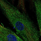 Immunofluorescent staining of human cell line ASC TERT1 shows localization to plasma membrane.