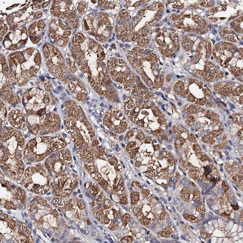 Anti-PPTC7 Antibody