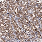 Anti-PPTC7 Antibody