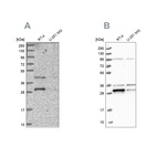 Western blot analysis using Anti-PPTC7 antibody HPA040614 (A) shows similar pattern to independent antibody HPA039335 (B).