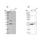 Western blot analysis using Anti-PPTC7 antibody HPA040614 (A) shows similar pattern to independent antibody HPA039335 (B).