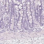 Immunohistochemical staining of human duodenum shows no positivity in glandular cells as expected.